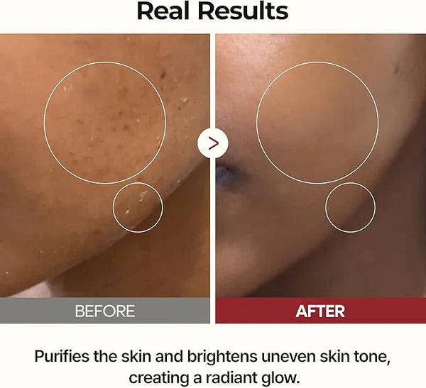 ✨ LAST DAY PROMOTION - BUY 1 GET 1 FREE✨Peel Shot Glow Rice Ampoule