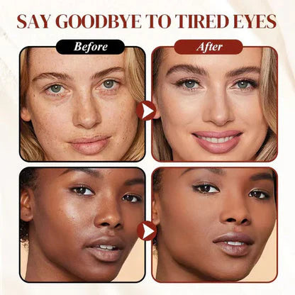 ✨ LAST DAY PROMOTION - BUY 1 GET 1 FREE✨Colored Clay Undereye Corrector