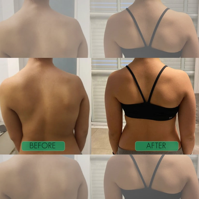 Fix Your Posture. Relieve Your Pain Naturally.